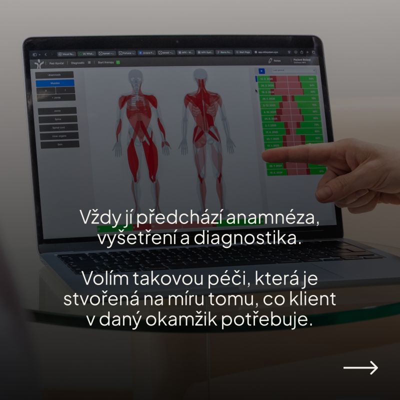 Notebook s mapou těla MFK a textem, že terapii vždy předchází anamnéza, vyšetření a diagnostika