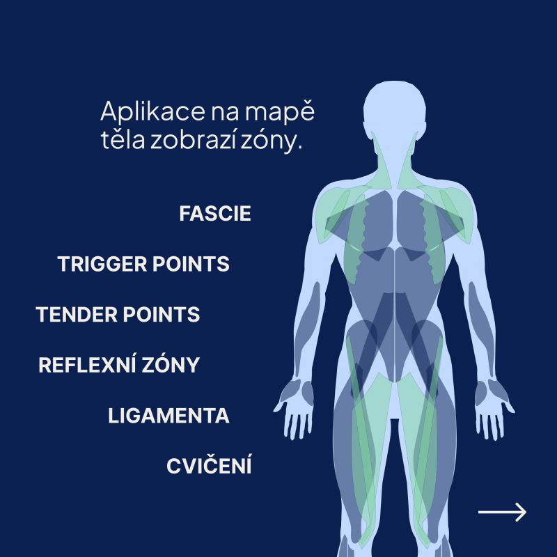Mapa těla se zónami: fascie, trigger points, tender points, reflexní zóny, ligamenta, cvičení